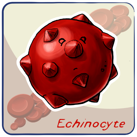 Echinocyte