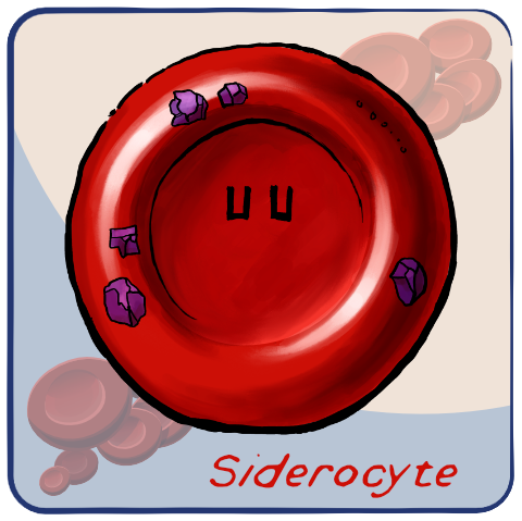 Siderocyte